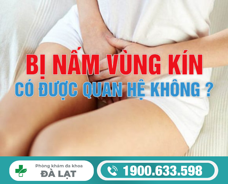 Hình ảnh minh họa